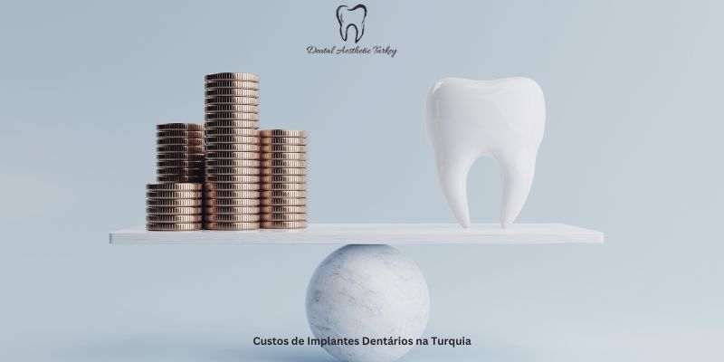 Custos de Implantes Dentários na Turquia