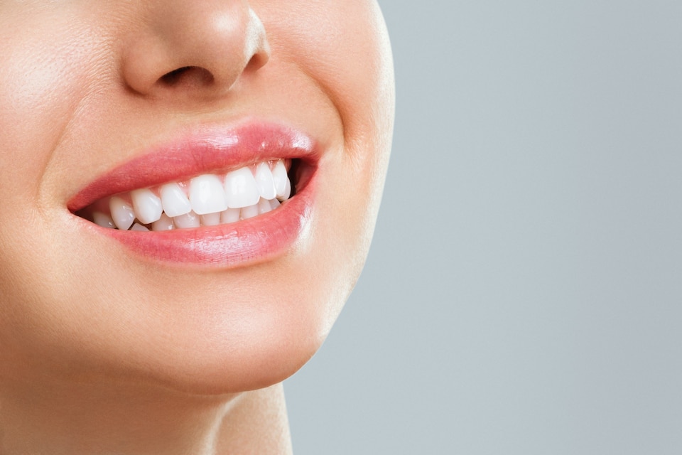 Smile Design Treatment Result of Women