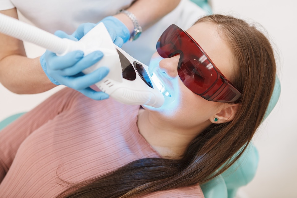 Laser Dental Bleaching Procedure