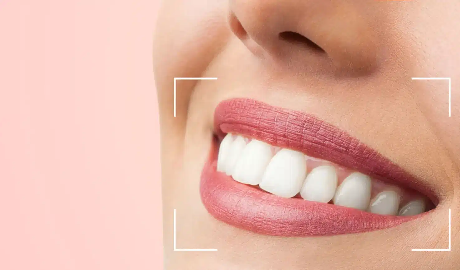 Facetas de Porcelana vs. Zircônia: Qual Escolher?
